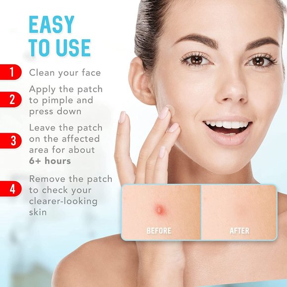 Bath Pimple Patches 12 Pack Hydrocolloid Acne Patches Zit Patch